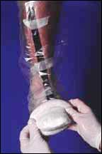 foot_mold_03