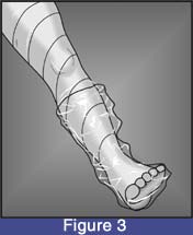 kneeKAFO_sleeve_03