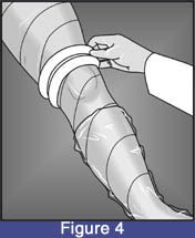 kneeKAFO_sleeve_04