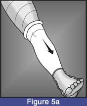 kneeKAFO_sleeve_05a