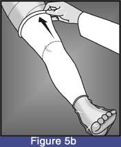 kneeKAFO_sleeve_05b