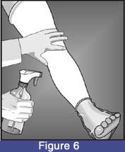 kneeKAFO_sleeve_06