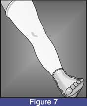 kneeKAFO_sleeve_07